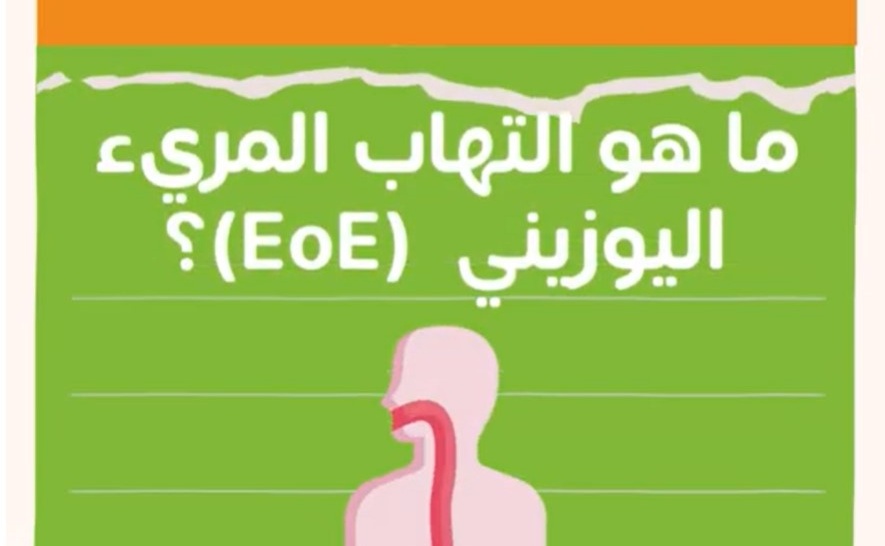 ما هو التهاب المريء اليوزيني (EoE) ؟